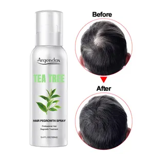 Spray de aceite para el crecimiento del cabello, tratamiento para el cuidado del cabello, antipérdida, Herbal, Etiqueta Privada