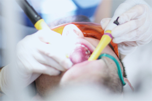 Tek kullanımlık <span class=keywords><strong>Dental</strong></span> tükürük çekici diş emme ucu üreticisi cerrahi tüpler - Product Image 3