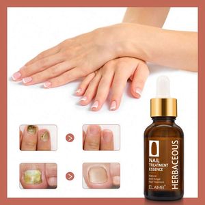 ELAIMEI Esencia para el Tratamiento de Uñas de 30 ml, <span class=keywords><strong>Antihongos</strong></span>, Acelera el Metabolismo de las Uñas, Nutre las Uñas de los Pies, Suero Reparador de Uñas - Product Image 6