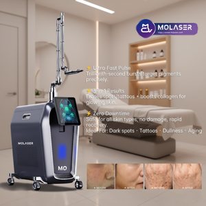Máquina de Eliminación de <span class=keywords><strong>Tatuajes</strong></span> con <span class=keywords><strong>Láser</strong></span> de Picosegundos, <span class=keywords><strong>Precio</strong></span> en India, Máquina de Eliminación de <span class=keywords><strong>Tatuajes</strong></span> con <span class=keywords><strong>Láser</strong></span> 2026, Eliminación de <span class=keywords><strong>Tatuajes</strong></span> con <span class=keywords><strong>Láser</strong></span> sin Dolor - Product Image 1