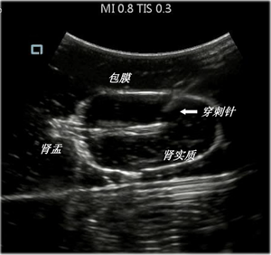 Ilmu Kedokteran Model Tusukan Ginjal Dipandu Oleh Ultrasound untuk Pelatihan B Praktek Pengajaran Perforasi Ginjal Ultrasonik - Product Image 5