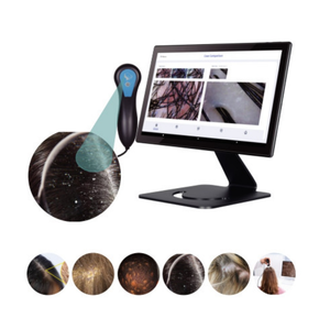 Microscope numérique portable pour cheveux, analyseur de cuir chevelu - Product Image 4