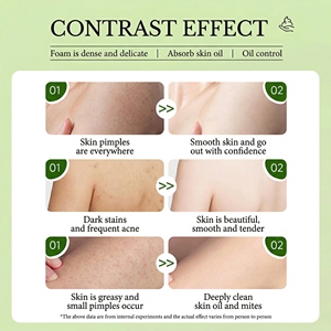 Jabón Acaricida de Carbón de Bambú Herbal Sólido OEM de Fábrica, 100g, Limpieza Profunda, Control de Grasa para Piel Grasa - Product Image 6