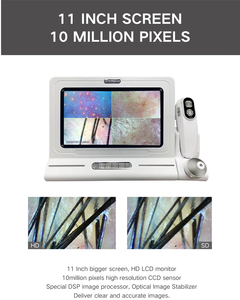 Máquina Profesional <span class=keywords><strong>para</strong></span> Análisis Capilar, Análisis <span class=keywords><strong>de</strong></span> <span class=keywords><strong>Cabello</strong></span> y Cuero Cabelludo, Máquina <span class=keywords><strong>de</strong></span> Prueba Capilar a <span class=keywords><strong>Precio</strong></span> Económico - Product Image 4