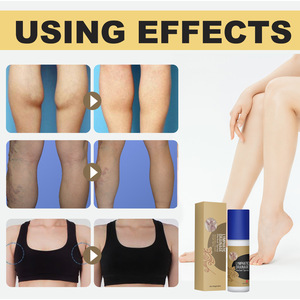 Spray Herbal OEM de <span class=keywords><strong>Drainage</strong></span> <span class=keywords><strong>Lymphatique</strong></span> Anti-Gonflement Traitement Efficace des Ganglions Sans Douleur pour les Seins - Product Image 2