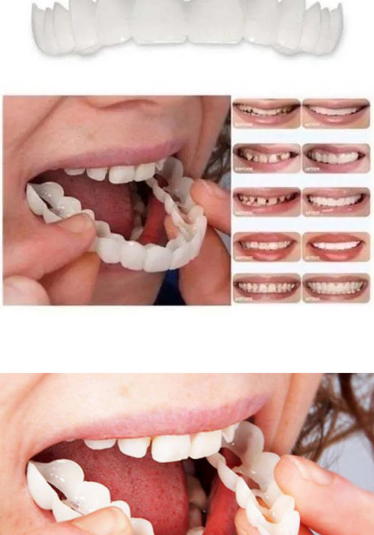 2021 New snap smile customized label Upper lower False teeth cover Perfect Smile Veneers Comfort Fit Flex Denture braces