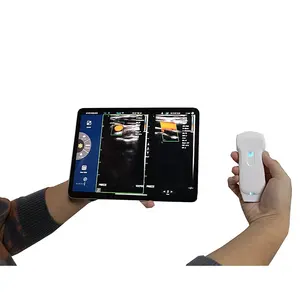 Mesin Ultrasound Scanner Mode B untuk Rumah Sakit Ipad Ultrasound Probe