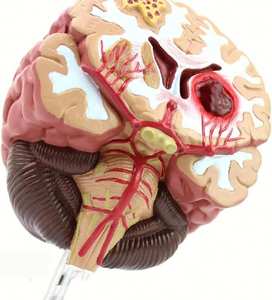 GelsonLab HSBM-564 Modelo de Cerebro Tipo Maniquí para Epilepsia, Hemorragia Cerebral y Patología de Malformación Arteriovenosa - Product Image 4