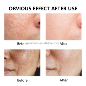 Brume pour le visage au <span class=keywords><strong>cidre</strong></span> de pomme en marque propre, clarifiante, équilibrante, sans alcool, tonique pour le visage - Product Image 4