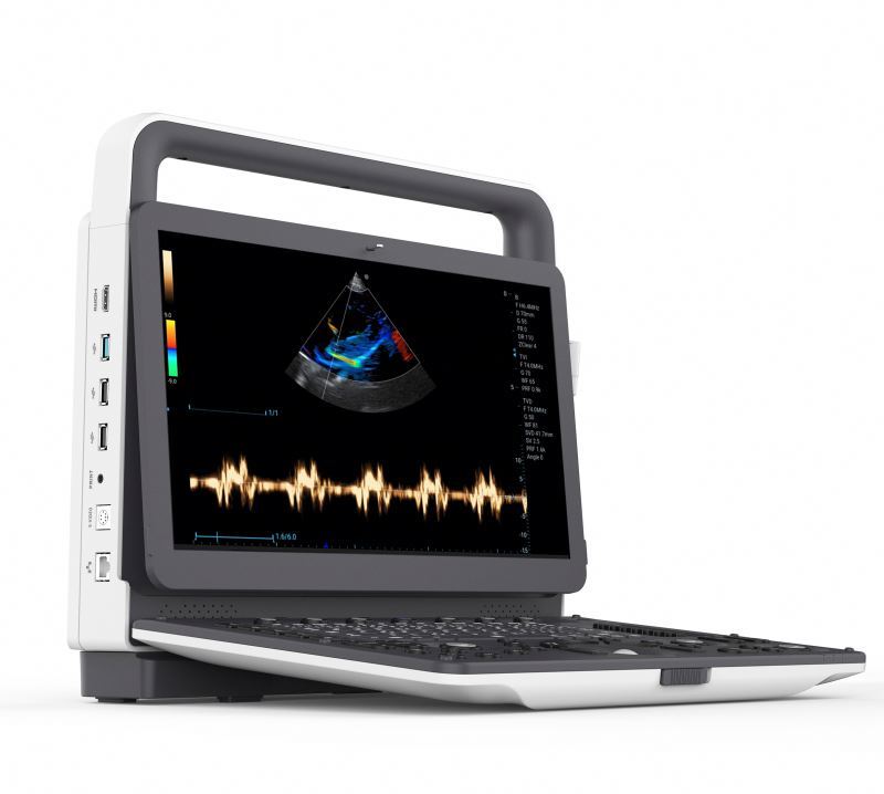 Advanced Obstetric Gynecological Imaging Equipment Electric