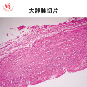 Microestructura típica de las pruebas de microscopio del sistema circulatorio, que incluyen venas grandes, arterias grandes y vasos renales después de la coloración HE. - Product Image 4