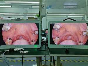 Kamera Endoskopi Medis Terintegrasi Portabel 24 Inci Full HD 1080p untuk Hewan THT/Laparoskopi/Urologi - Product Image 3