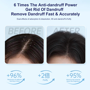 Wholesale Anti Dandruff <strong>Shampoo</strong> <strong>Customised</strong> Natural Plant Extract Refreshing Moisture Organic Natural <strong>Shampoo</strong> and Conditioner - Product Image 2