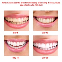 Tiras de blanqueamiento dental, sin fluoruro, seguro, blanqueamiento dental avanzado, blanqueamiento dental opalescente