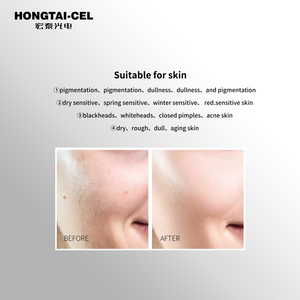 Appareil de peeling à jet de glace de qualité professionnelle, <span class=keywords><strong>a</strong></span>érosol transdermique + régénération du collagène - Product Image 4
