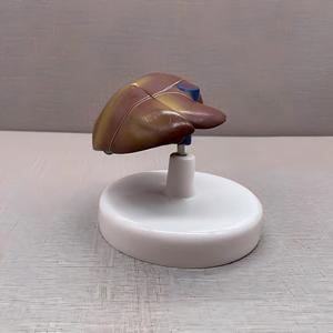 Modèle pédagogique biologique de pathologie hépatique avec base - Outil de démonstration anatomique pour l'enseignement de la hépatologie - Product Image 2