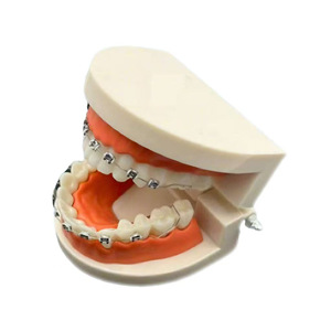 Cross-border dental fashion braces decorative chain, dental braces decoration, orthodontic dental model, orthodontic <b>brackets</b> - Product Image 1