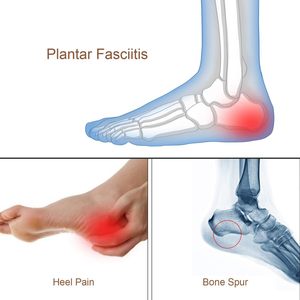 <span class=keywords><strong>Plantillas</strong></span> de gel de silicona <span class=keywords><strong>para</strong></span> el talón, <span class=keywords><strong>plantillas</strong></span> <span class=keywords><strong>para</strong></span> zapatos <span class=keywords><strong>para</strong></span> fascitis plantar, dolor en el talón, espolón óseo, cojín <span class=keywords><strong>para</strong></span> el talón que absorbe el dolor de Aquiles - Product Image 3