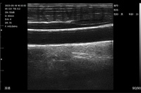 Escáner de Ultrasonido Portátil Intercambiable 6 en 1 C8 para Cardiología, Abdomen, Vasos Sanguíneos, Uso Humano y Veterinario, Máquina de Ultrasonido de Mano