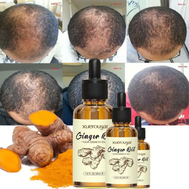Aceite para el cabello orgánico natural, aceites esenciales para el crecimiento del jengibre, tratamiento para la pérdida del cuidado nutritivo, suero para el cuero cabelludo, aceite para el crecimiento del cabello