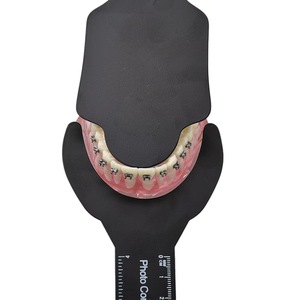 Foto dentale specchio intraorale ortodontico sfondo nero piastra di bordo Set kit di contrasto foto dentale - Product Image 3