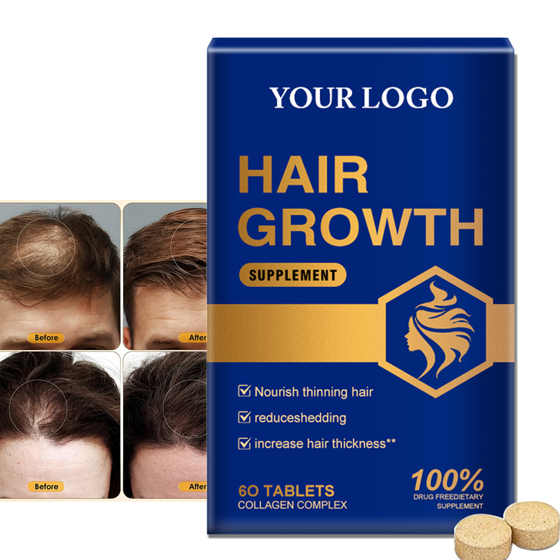 Factory Wholesale OEM Collagen Gummies Supports