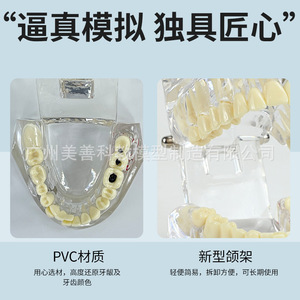 Modelos dentales, modelos de patología dental transparentes naturales, modelos de patología dental y modelos médico-paciente. - Product Image 5