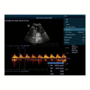 Instrumento de ultrasonido médico DP20 2D Color Doppler Ultrasonido Uso humano Digital <span class=keywords><strong>Mindray</strong></span> BW Ultrasonido - Product Image 6