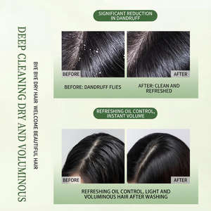 Shampoo antipelliculaire en gros, contrôle du sébum, biologique, naturel, perte de cheveux, marque privée, sans sulfate, shampooing nettoyant en profondeur, OEM ODM - Product Image 4