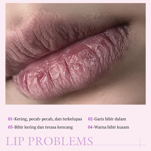 KORMESIC Certifié Bpom Vente en gros 2,7g Baume à lèvres hydratant et éclaircissant qui améliore la texture des lèvres, couleur fraise - Product Image 2