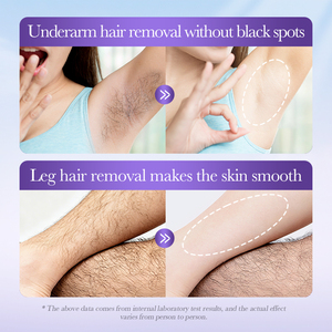 Crema Depilatoria Sadoer Lavanda OEM de Acción Rápida y Efectiva para Suavizar y Refrescar la Piel Diariamente con Fórmula Nutritiva 100g - Product Image 4