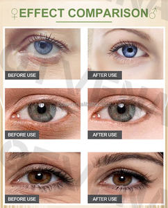 Otvena Brightening Eye Skin riparazione incandescente sotto la <span class=keywords><strong>crema</strong></span> per gli <span class=keywords><strong>occhi</strong></span> per <span class=keywords><strong>borse</strong></span> per gli <span class=keywords><strong>occhi</strong></span> antirughe istantanee rimozione del gonfiore delle occhiaie - Product Image 6