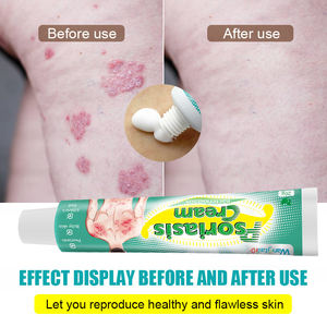 Ungüento Tópico Wangtailin para la Dermatitis Fúngica y <span class=keywords><strong>el</strong></span> Eccema, Anti-picazón, Bacteriostático, 20g - Product Image 4