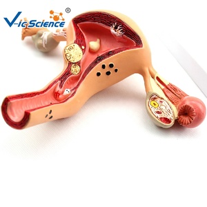 Khoa học y tế mô hình tử cung mô hình giáo dục tử cung giải phẫu người - Product Image 4