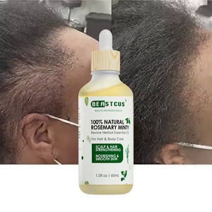 Private Label <span class=keywords><strong>fatto</strong></span> <span class=keywords><strong>in</strong></span> <span class=keywords><strong>casa</strong></span> a base <span class=keywords><strong>di</strong></span> erbe vegane oliva Jojoba ricino rosmarino Avocado e menta piperita <span class=keywords><strong>olio</strong></span> per la crescita dei capelli per gli uomini - Product Image 1