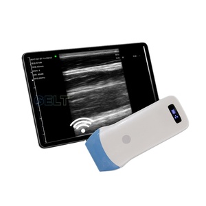 USB <span class=keywords><strong>usg</strong></span> wifi Instrument vétérinaire vache bovine équine grossesse USB sonde linéaire ecografo portable ecographe - Product Image 1