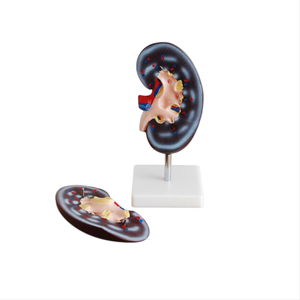 Modelo Anatómico de Riñón de 1 y 2 Partes para Demostración de Enfermedades, Herramienta de Enseñanza Médica, Modelo Médico - Product Image 3