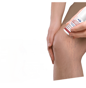 Crème pour <span class=keywords><strong>varices</strong></span> <span class=keywords><strong>Traitement</strong></span> des <span class=keywords><strong>varices</strong></span> pour le soulagement de la douleur des jambes 50g OEM ODM - Product Image 2