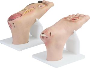 Modelo de pie diabético (leve/severo) para formación médica, maniquí preventivo para el pie diabético, silicona CE/ISO - Product Image 5