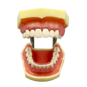 Oraal Model Voor Het Oefenen Van Parodontale Pathologie Tandheelkundige Calculusschaling - Product Image 1