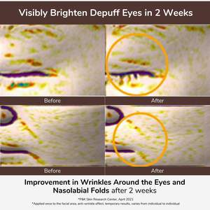 Crema Intensiva para Ojos con Ácido Hialurónico Elensilia 20 Mililitros Cuatro Estaciones Estilo Japonés y Coreano Antiarrugas Energizante Cuidado de la Piel - Product Image 6