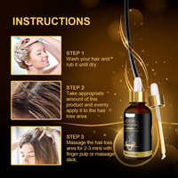 Minyak penumbuh rambut Losion Perbaikan sehat 30ml untuk pria wanita kebotakan kulit esensi rambut Sturgeon