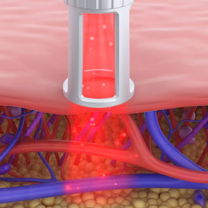 Klasse 4 Veterinär-Laser therapie geräte 810nm 980nm Für Tiere Reduzieren Sie Schmerzen und Entzündungen - Product Image 6