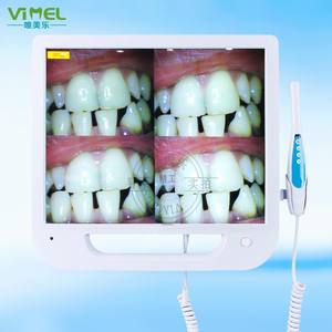 Instrument d'examen dentaire tout-en-un de 17 pouces, interface VGA, enregistrement vidéo haute définition, carte SD pour microscope dentaire - Product Image 2