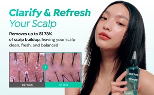 Champú Refrescante de Menta para el Cuero Cabelludo, Elimina la Acumulación de Residuos y Controla el Exceso de Grasa, Calmante y sin Olor, con Logotipo Personalizado - Product Image 3