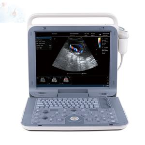 15 Inch Veterinaire Echocardiografie Machine Menselijk Gebruik Cardiale 3d/4d Veterinaire Kleur <span class=keywords><strong>Doppler</strong></span> Echografie Draagbare - Product Image 1