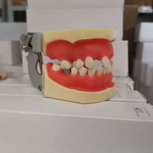 Modello di impianto dentale KyrenMed con edentulismo parziale nelle mascelle superiori e inferiori denti modello di pratica mancante - Product Image 4