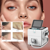 Appareil de réduction permanente des poils au laser diode de qualité professionnelle avec une grande efficacité énergétique, une grande taille de spot, un design portable, une puissance de 1200 W