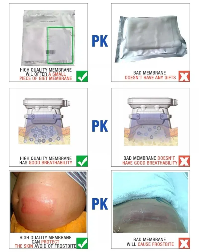 Chống đóng băng màng màng cho 360 Cryo lipolysis chất béo đóng băng cơ thể Máy giảm béo Cryo chất béo đóng băng điêu khắc