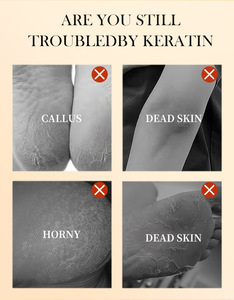 สเปรย์ขัดผิว VC สำหรับเท้า สามารถใช้ได้ทั่วร่างกายเพื่อปรับสีผิวให้กระจ่างใส ขัดผิวหน้าด้วยขมิ้น - Product Image 4